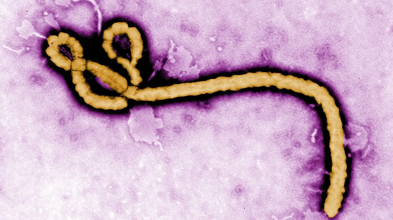 Ebola virüsü nedir?