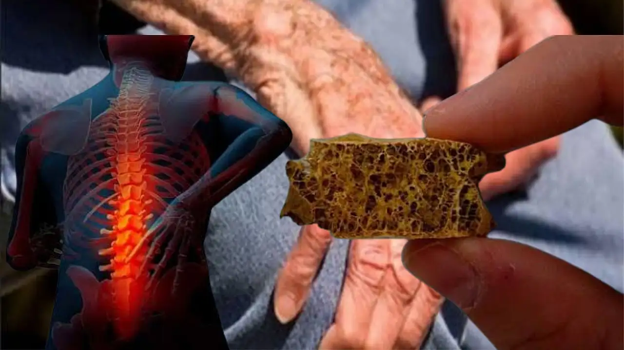 Kemik erimesi sessiz ilerliyor! Erken tanı kırık riskini azaltıyor