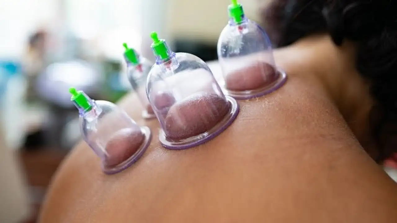 Eylül ayı hacamat günleri ne zaman? Altın gün yaklaşıyor!