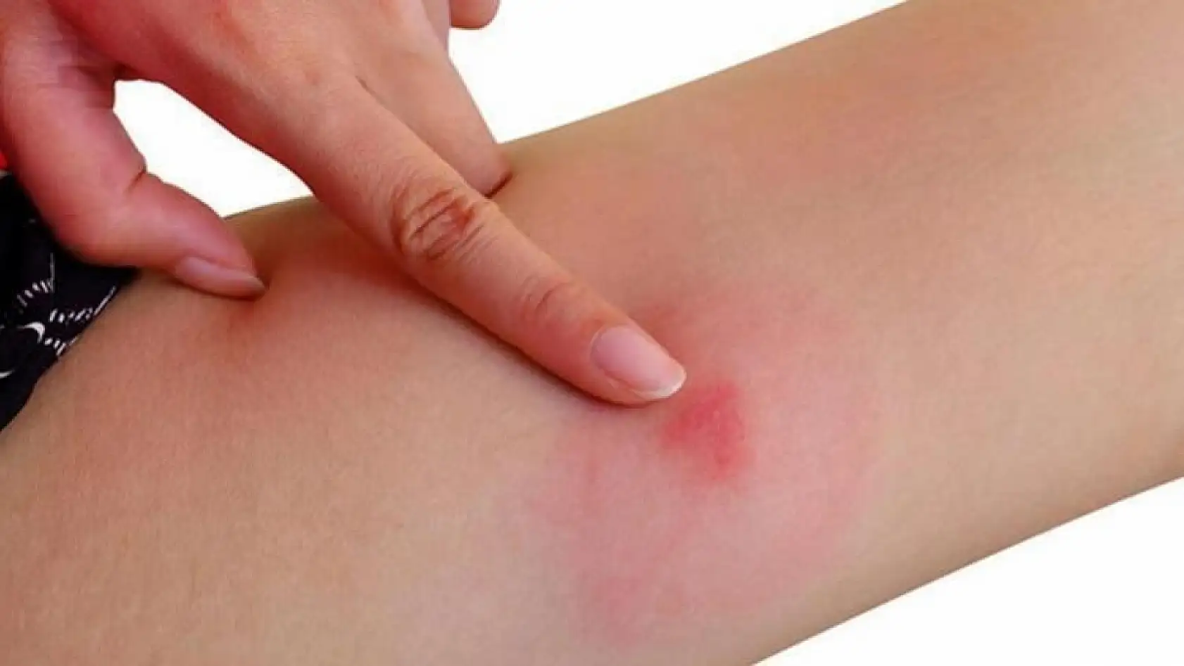 Kayserililerin başı dertte – Bir türlü kurtulamıyorlar!