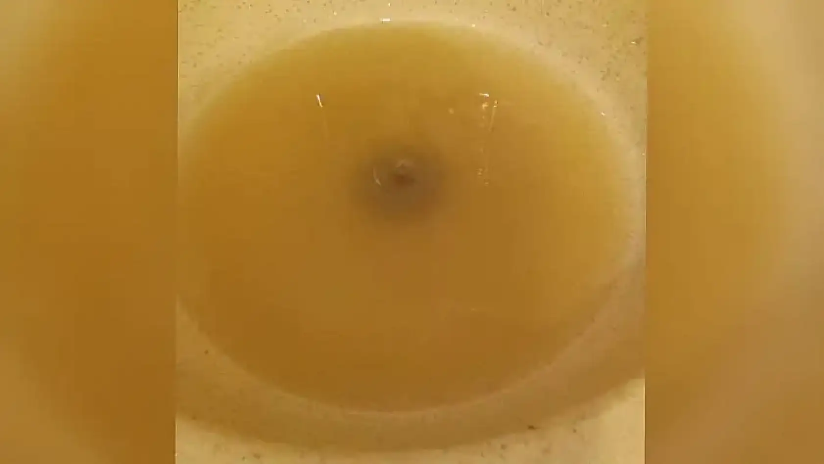 Kayseri'den kısa kısa: Trafik kazası, Aşkın Genç, Develi, Çamurlu su…