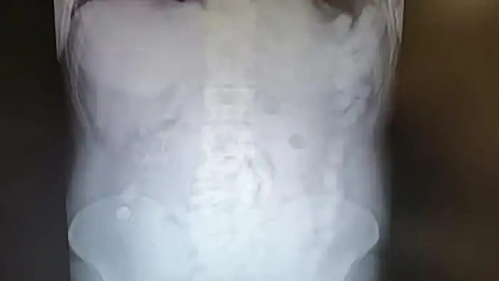 Kayseri kısa kısa: Uyuşturucu, toplu balık ölümü, Baki Ersoy, StartUpMYO, Kayserispor....