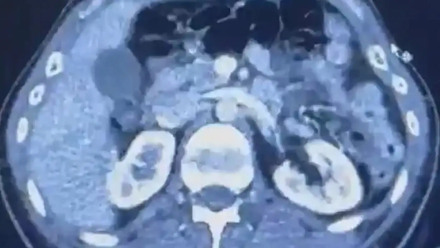 Kayseri'den kısa kısa: Cinayet, Dev Şirketler, Konut Fiyatları, Havalimanı, Kayserispor…