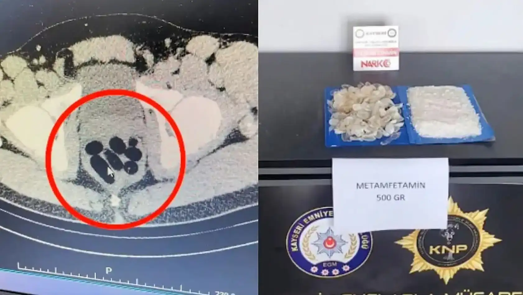 Kayseri'den Kısa Kısa: Uyuşturucu, Zincirleme Kaza, Yeni Lise, Otobüs Güzergah Değişikliği, Kayserispor…