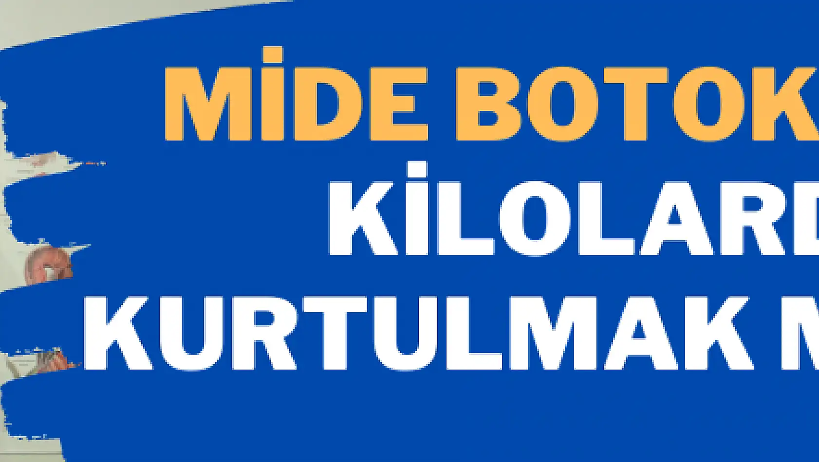 Mide botoksuyla kilolardan kurtulmak mümkün