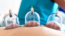 Kayseri'de hacamat yaptıracaklar dikkat! Temmuz takvimi belli oldu