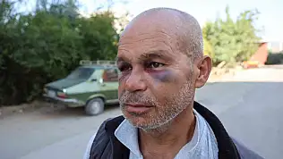 Duyma ve konuşma engelli adamı darp ettiler, aile şikayetçi oldu