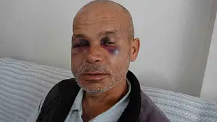 Engelli adamı darbeden şüpheli serbest bırakıldı