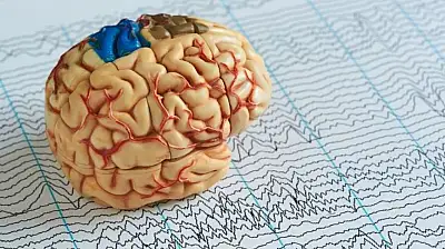 Sağlık Bakanlığı'ndan hayat kurtaran liste: Epilepsi nöbetinde ne yapılır?