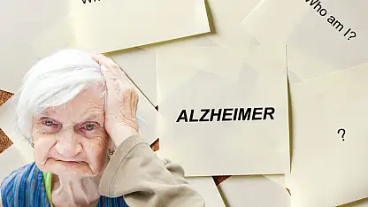 Alzheimer tedavisinde umut veren gelişme: Test aşamasında kritik detay!