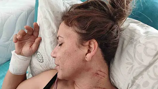 Emlakçı kadını vurdular, silah tutukluk yapınca hayatta kaldı