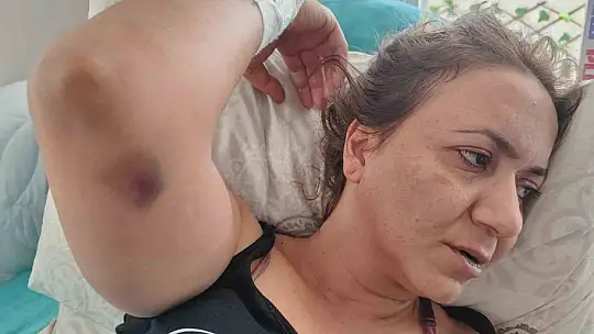 Emlakçı kadını vurdular, silah tutukluk yapınca hayatta kaldı