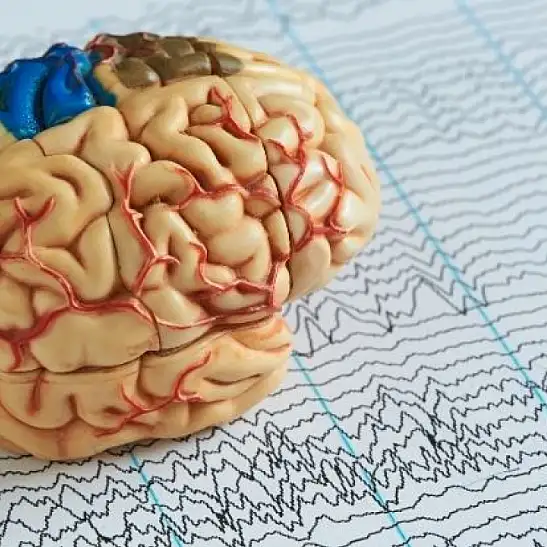 Sağlık Bakanlığı’ndan hayat kurtaran liste: Epilepsi nöbetinde ne yapılır?