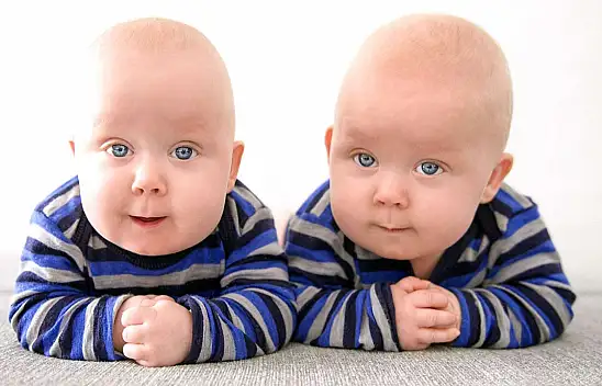 Bu ilginç olay çok konuşulur! İkiz bebekler...