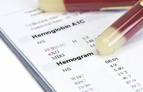 Gribal şikayetler artıyor - Korkutan gerçek ortaya çıktı!