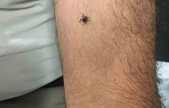 Kayseri'nin bir ilçesinde daha bir yeni kene vakası!