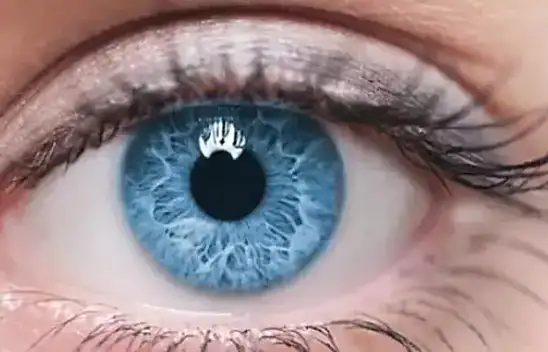 Kayserili uzman açıkladı - Gözlük bırakmak artık mümkün!