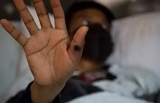 Maymun çiçeği o ili alarma geçirdi!