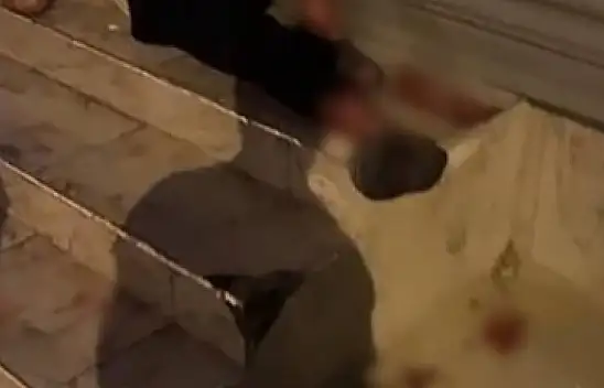 Adana'daki Pitbull Saldırısının Detayları Ortaya Çıktı!