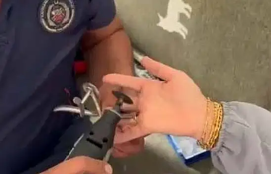 Parmağa sıkışan yüzük bakın nasıl çıkarıldı?