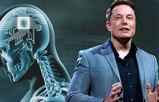 Sonunda bu da oldu- İlk cyborg doğdu!