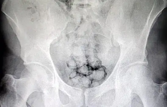 Yok artık! Şeytanın bile aklına gelmez...