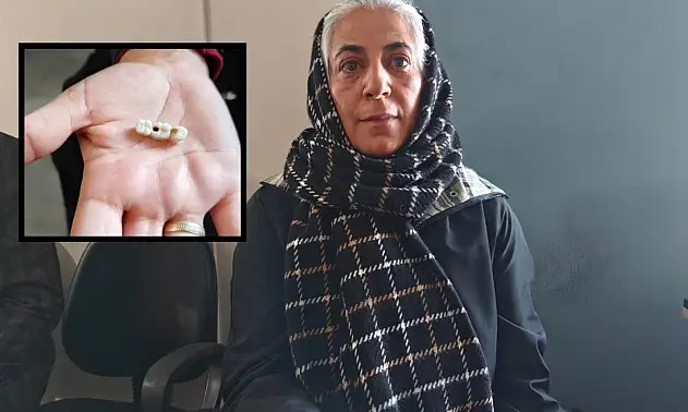 Kayseri'de implant elinde hasta şikayette