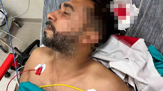 Döner ustası çalışırken yorgun mermiyle yaralandı