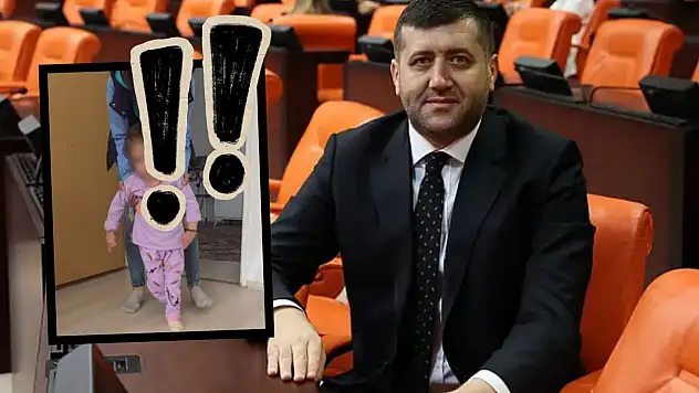 Baki Ersoy serebral palsi hastası için devreye girdi!