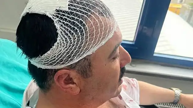 Belediye başkan yardımcısını şekerlikle yaralayan YRP'li başkan yardımcısı tutuklandı!