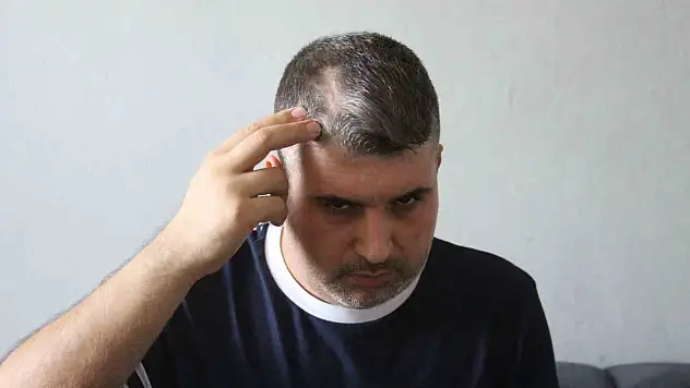 Dayısı beyzbol sopasıyla saldırmıştı: 'Can güvenliğim yok'