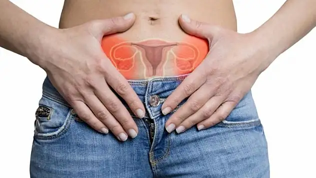 Çikolata kisti kısırlık nedeni olabilir mi? Uzmanından uyarılar