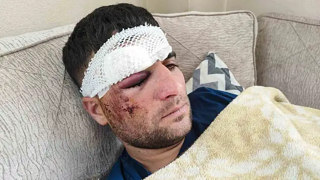 Döner ustasından kaza sonrası sitem: 'Keşke gelip bana baksalardı'
