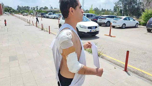 Adana'da kurt köpeği saldırısına uğradı!