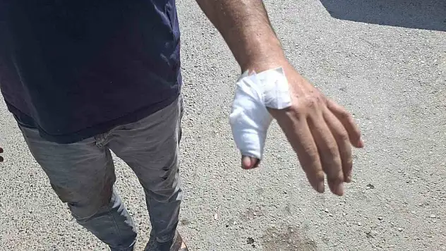 Kahramanmaraş'ta acemi kasaplar soluğu hastanede aldı!