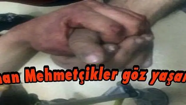 Yaralı kahraman Mehmetçikler göz yaşarttı, ders verdi