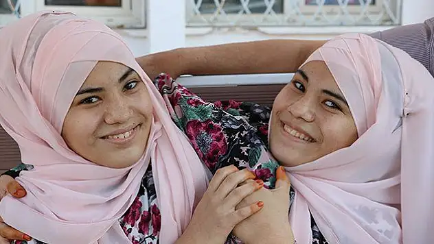 Siyam ikizlerinin üniversite hayali gerçek oluyor
