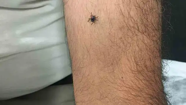 Kayseri'nin bir ilçesinde daha bir yeni kene vakası!