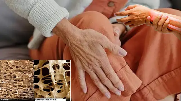 Kemik erimesi sessiz ilerliyor! Erken tanı kırık riskini azaltıyor
