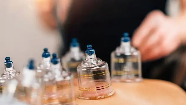 Mayıs ayı hacamat günleri ne zaman? İşte en uygun tarihler