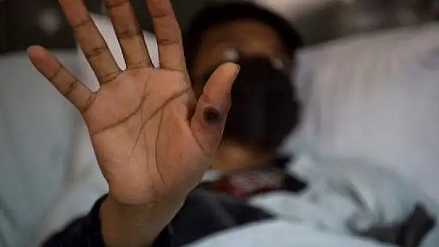 Maymun çiçeği o ili alarma geçirdi!