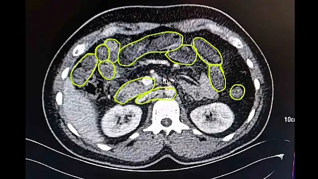 Ankara yolunda Kayseri'ye gelemeden yakalandılar