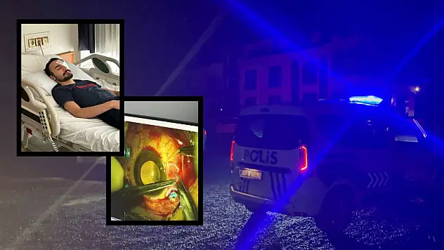 Nevşehir'de kayınbabası tüfekle gözünden vurdu: ERÜ Hastanelerine sevk edilen damadın durumu kritik!