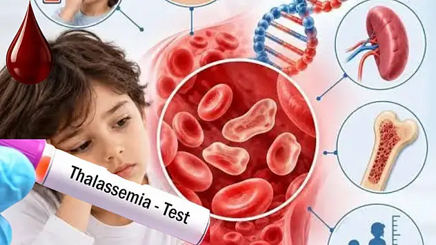 Talasemi hastalığına dikkat! Anne ve babadan çocuklara geçiyor…