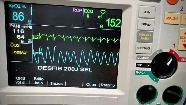 Taşikardi şoku! Hakem maça çıkamadı – Taşikardi nedir, belirtileri neler?