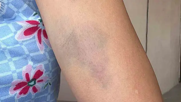 Veteriner ve ailesine 'besleme' dayağı iddiası