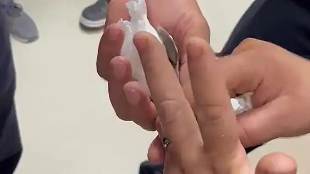 Parmağına sıkışan yüzüğü itfaiye çıkardı