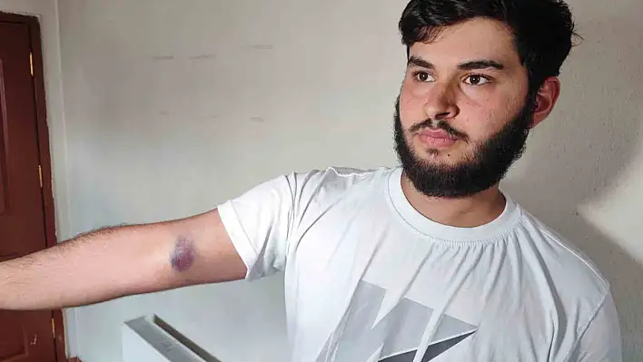 Adana'da top yüzünden çıkan tartışma saldırıya dönüştü