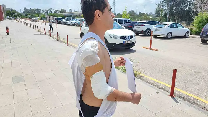 Adana'da kurt köpeği saldırısına uğradı!