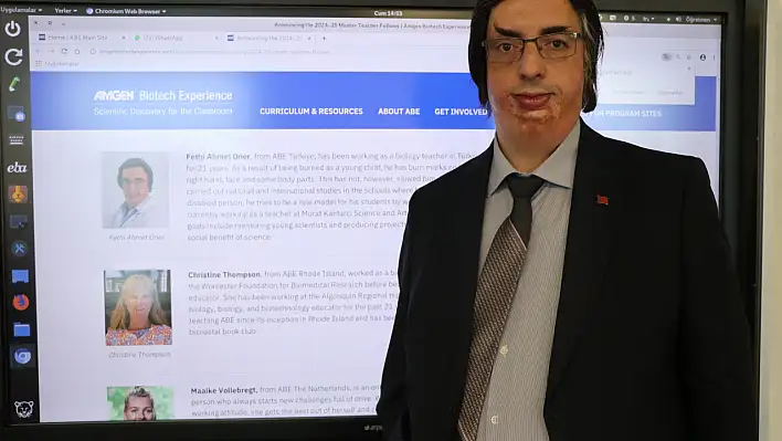 Hayat mücadelesiyle ilham verdi: ABD'de 'usta öğretmen' seçildi